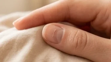 Bề mặt đầu ngón tay bị nứt rạn giúp giải đáp móng tay bị gãy ngang là điềm gì về sức khỏe và phong thủy