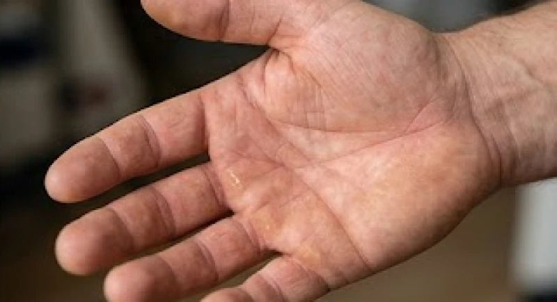 Cấu trúc lòng bàn tay có nếp gấp cơ học thô ráp do quá trình lao động nặng nhọc