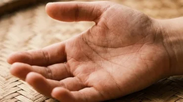 Hình ảnh giải mã ngứa lòng bàn tay là điềm gì theo phong thủy và góc độ y khoa da liễu