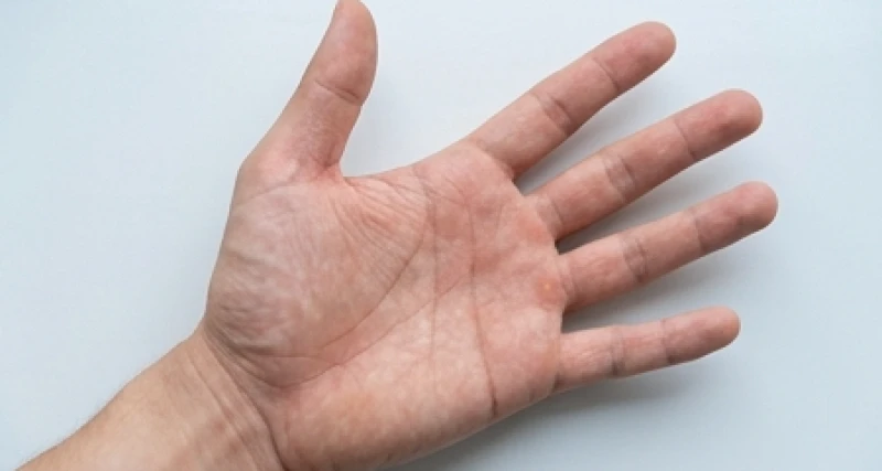 Đường sinh mệnh đôi ở tay phải: Luận giải nam nữ và hóa giải 2 Lòng bàn tay dưới ánh sáng tự nhiên lộ rõ hai đường sinh đạo song song không cắt chéo