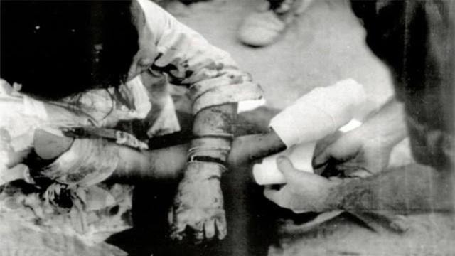Trần Thị Được (16 tuổi) đang được binh sĩ Hoa Kỳ chữa trị vết thương do binh sĩ Hàn Quốc gây ra trong vụ thảm sát Thảm sát Phong Nhất và Phong Nhị năm 1968