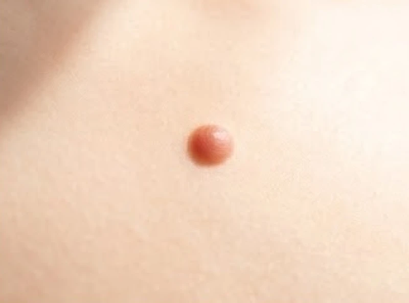 Nốt ruồi có hình dáng tròn đều và màu sắc tươi sáng mang lại vượng khí