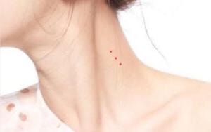 Nốt ruồi son thường là những chấm hồng hoặc đỏ trên da, rất dễ nhận biết