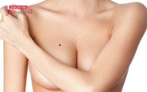 Ý nghĩa của nốt ruồi phụ thuộc vào vị trí mà nó nằm trên ngực