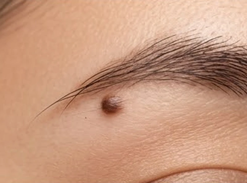 Nốt ruồi trên lông mày có mọc kèm sợi lông tơ thanh mảnh biểu thị sức khỏe và vượng khí