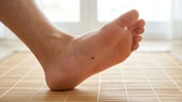 Nốt ruồi ở lòng bàn chân phải nam giới biểu thị cho sự vận động và những điềm báo phong thủy quan trọng