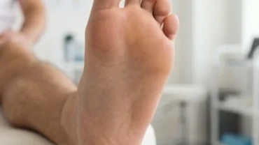 Hình thể nốt ruồi ở lòng bàn chân trái nam giới phản ánh ý nghĩa phong thủy và tình trạng sức khỏe