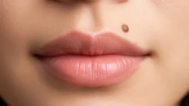 Cận cảnh nốt ruồi ở môi của một phụ nữ châu Á với làn da sáng mịn và đôi môi hồng hào khỏe mạnh