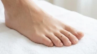 Bàn chân người trưởng thành khỏe mạnh với một nốt ruồi nhỏ ở ngón chân dưới ánh sáng tự nhiên