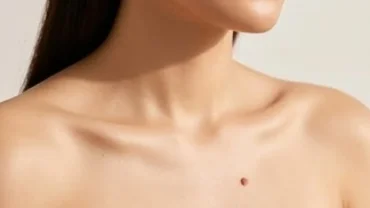 Nốt ruồi ở ngực trái của phụ nữ mang nhiều ý nghĩa phong thủy tốt đẹp và cần được theo dõi y tế cẩn thận