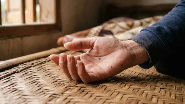 Hình ảnh chi tiết nốt ruồi ở tay kết hợp xem tướng số phong thủy và cảnh báo sức khỏe y khoa