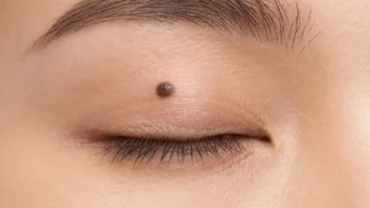 Nốt ruồi trên mí mắt sắc nét của phụ nữ Á Đông nổi bật trong ánh sáng tự nhiên