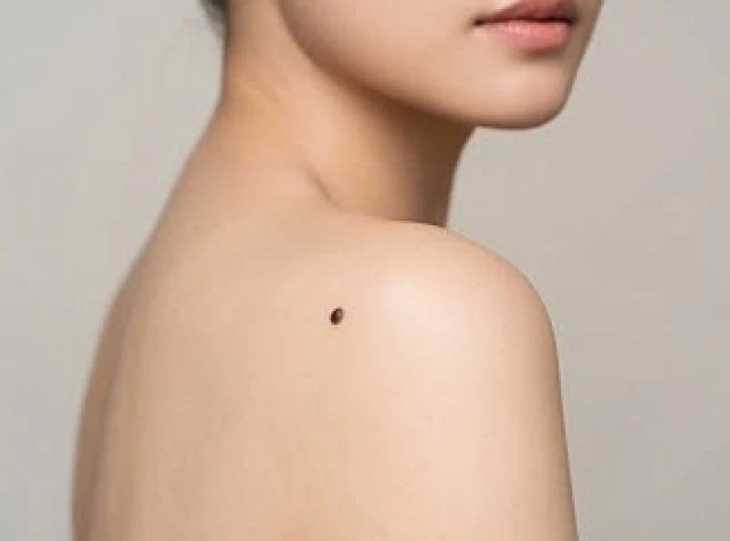 Vị trí nốt ruồi trên vai trái của phụ nữ mang lại điềm báo về tài chính vững mạnh và sự nghiệp độc lập