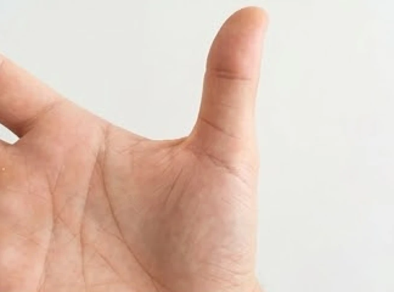 Đường sức khỏe bị đứt đoạn: Ý nghĩa và dấu hiệu hóa giải 4 Bàn tay với ngón cái mở rộng để lộ rõ đường sinh mệnh uốn cong vòng quanh gò Kim Tinh