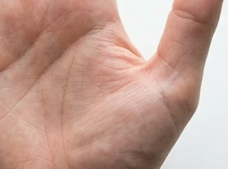 Lòng bàn tay mở rộng cho thấy vòng cung sinh đạo sâu đậm ôm sát ngón cái hoàn toàn tách biệt với vân chéo bên rìa