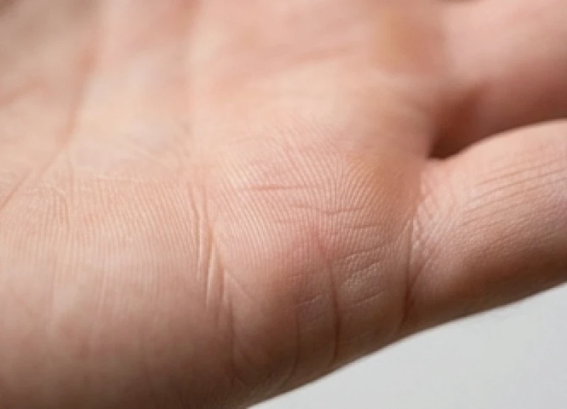 Sự khác biệt giữa vân tay nằm ngang lộn xộn và đường con cái mọc thẳng đứng