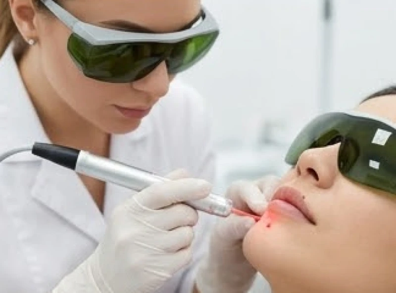 Nốt ruồi ở môi dưới: Ý nghĩa tướng số, chi phí & cách chăm sóc 8 Bác sĩ da liễu sử dụng thiết bị laser chuyên dụng xử lý sắc tố quanh viền môi