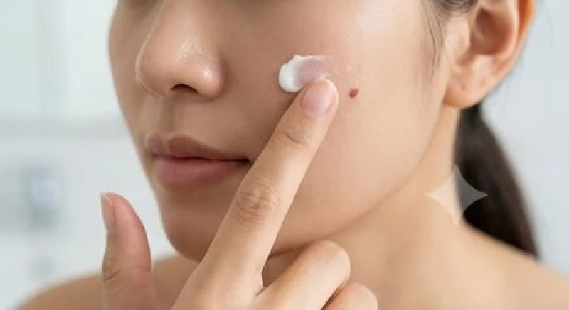 Quá trình chăm sóc và bôi kem dưỡng phục hồi lên vùng da vừa tẩy nốt ruồi
