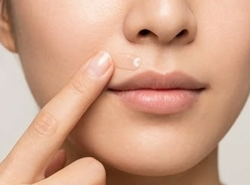 Nốt ruồi dưới mũi: Ý nghĩa tướng số nam nữ & vị trí nhân trung 7 Sử dụng kem trị sẹo tái tạo da thoa lên vùng nốt ruồi dưới mũi vừa bong vảy
