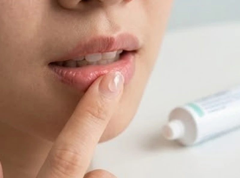 Sử dụng gel bôi niêm mạc chuyên dụng giúp vết thương rách môi mau lành