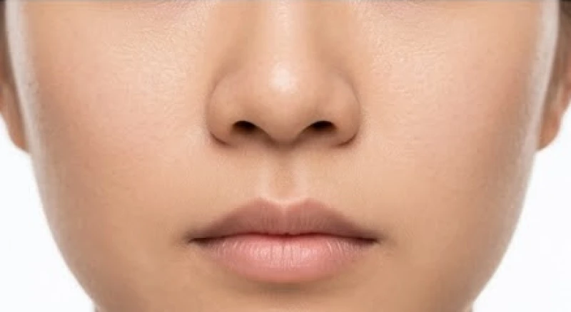 Cận cảnh vùng da dưới mũi có rãnh vừa nông vừa hẹp sát nhau của một người phụ nữ Á Đông