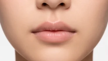 Cận cảnh khuôn mặt có tướng nhân trung lệch với đường rãnh môi xê dịch nhẹ so với trục giữa