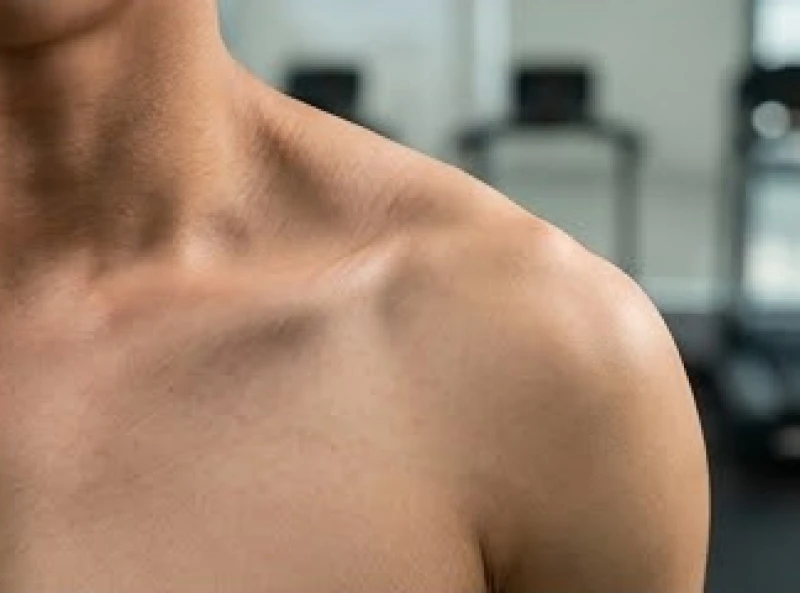 Nguyên nhân gây vai lệch do thói quen ngồi làm việc sai tư thế khiến nhóm cơ thang bị co rút và sưng to
