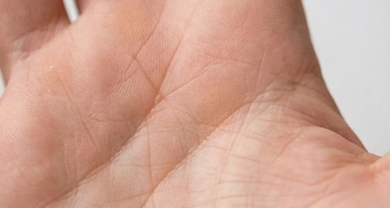 Gò Mộc Tinh trên bàn tay: Ý nghĩa công danh và cách hóa giải 6 Đường chỉ tay hội tụ thành vân hình ngôi sao sắc nét nằm độc lập ngay trung tâm gò Mộc Tinh