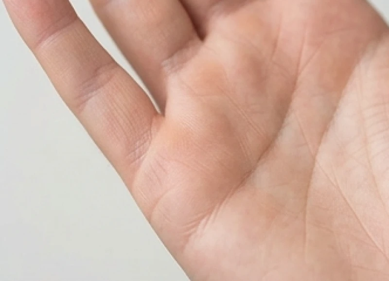 Vị trí chính xác của đường con cái trên rìa ngoài gò Thủy tinh của bàn tay