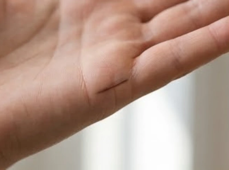 Chia khoảng cách cạnh bàn tay thành bốn phần để ước tính mốc thời gian lập gia đình