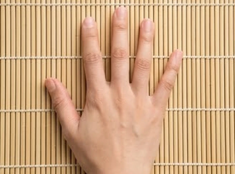 Bàn tay xòe rộng trên mặt bàn để lộ rõ năm ngón tay cùng các vị trí nốt ruồi đặc trưng