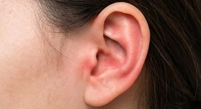 Nóng tai là điềm gì: Tra cứu 12 khung giờ nam nữ và mẹo xử lý 5 Vành tai sưng tấy và đỏ rát kéo dài là dấu hiệu cảnh báo tổn thương mô sụn