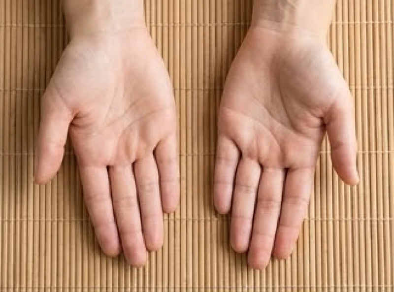 So sánh hai bàn tay để đánh giá khách quan đường hôn nhân rẽ nhánh bẩm sinh