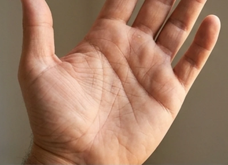 Lòng bàn tay lộ rõ các đường chỉ tay đứt đoạn và vân hình đảo nhỏ