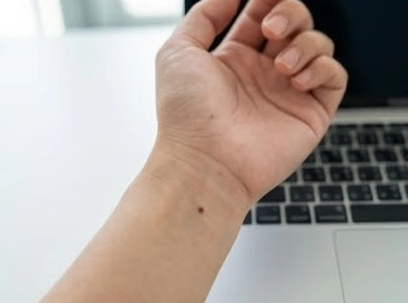 Bề mặt trong cổ tay hiện rõ đặc điểm nốt ruồi ở tay của người đang làm việc, biểu hiện sự nhạy bén